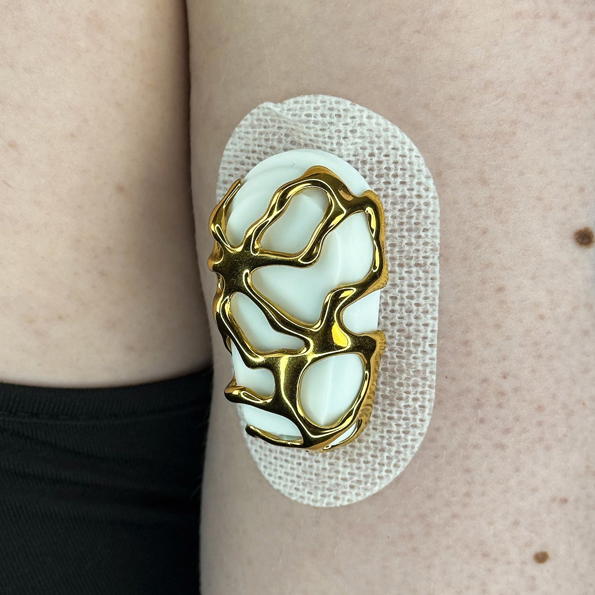 Gold Venom Armour for Dexcom G6, worn on the body