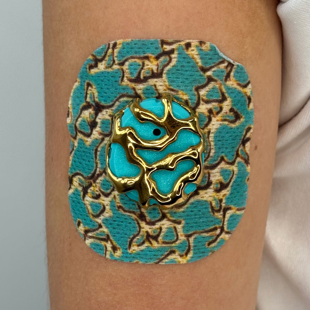 Cyan Venom CGM patch with a gold finish for Dexcom G7